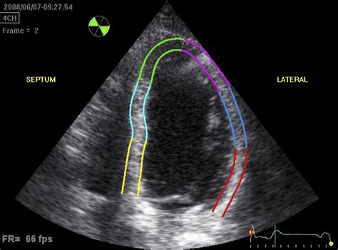 Echocardiogram: Types and What They Show.